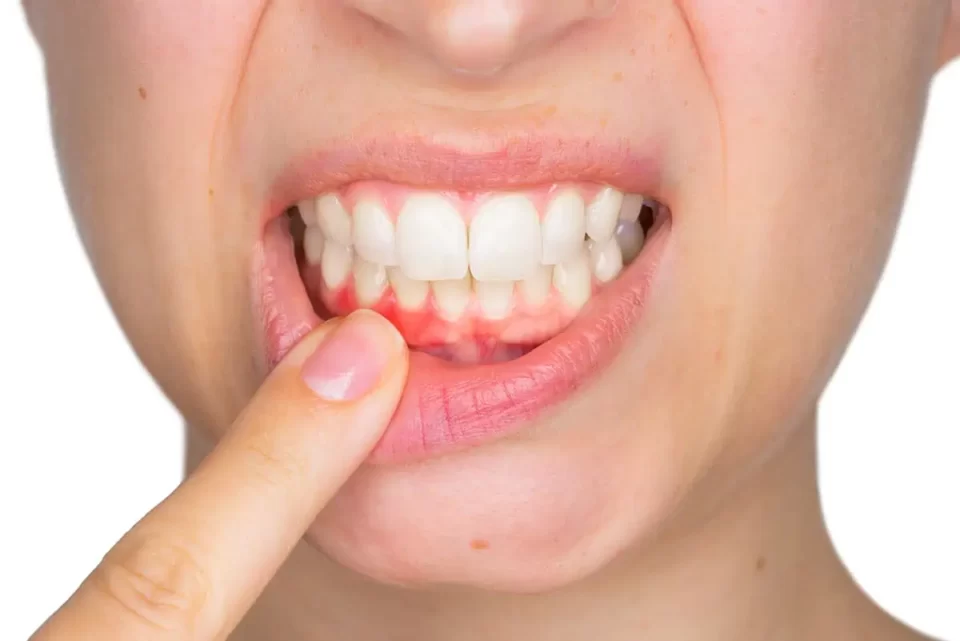 Signs of serious dental problems you should never ignore