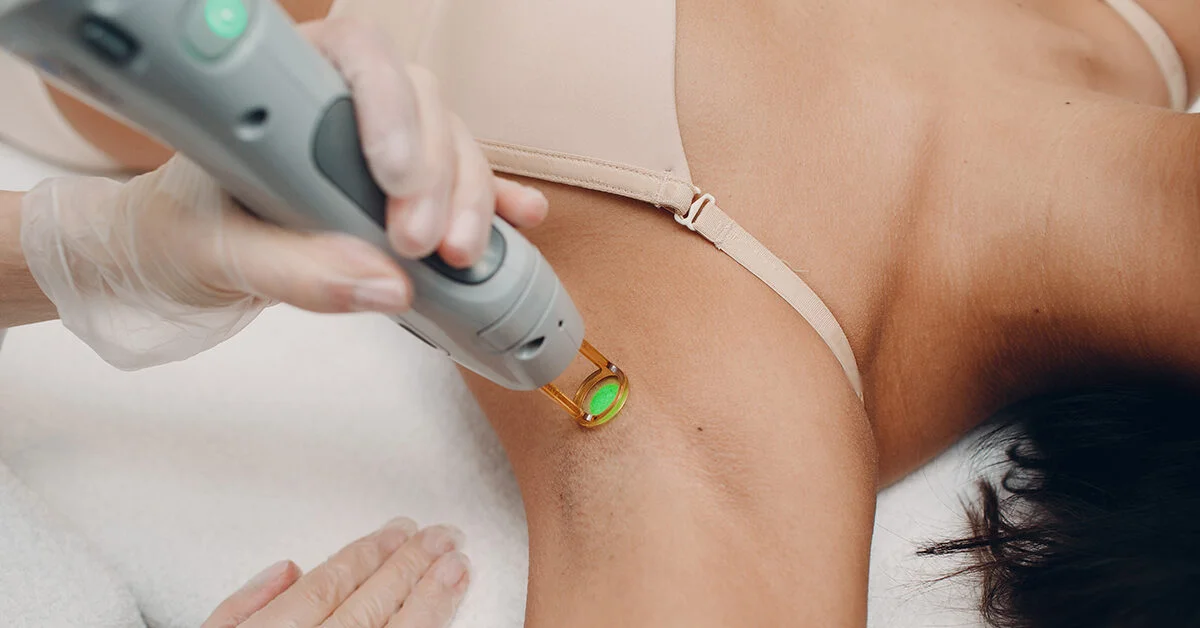 Laser Hair Removal