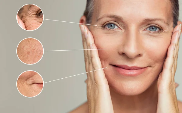 Aging Skin: Issues, Remedies, and Treatments